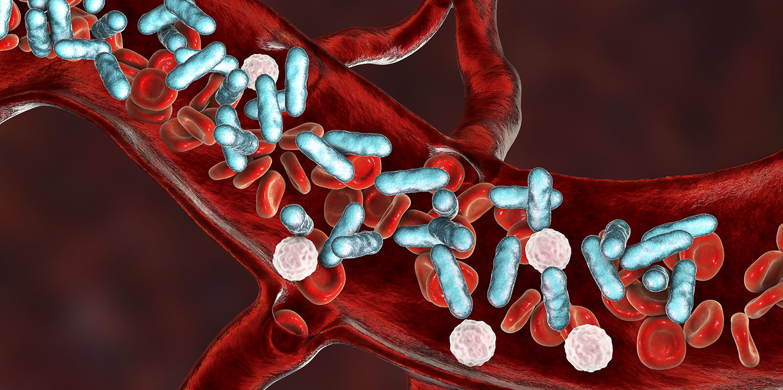30 Fakten Über Sepsis