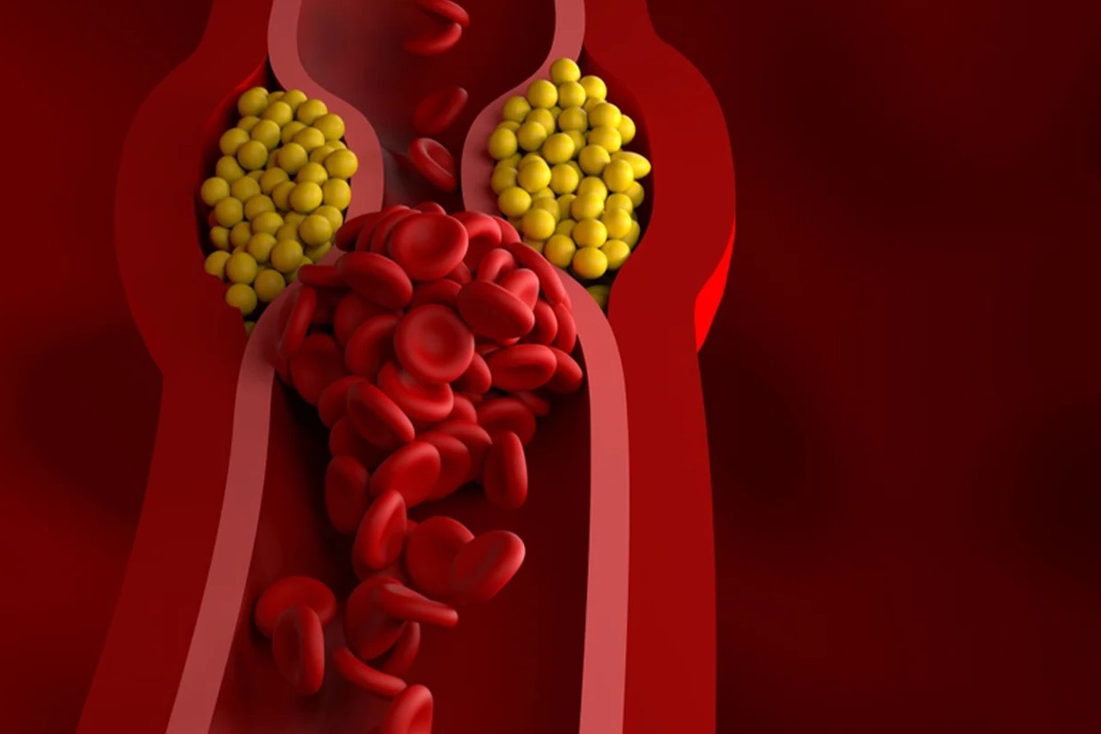 27 Fakten Über Triglyceride